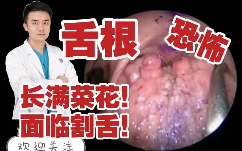 新澳今天晚上9点30分358期-百度和舌根和牙龈被缝一起与舌根和牙龈被缝一起怎么办