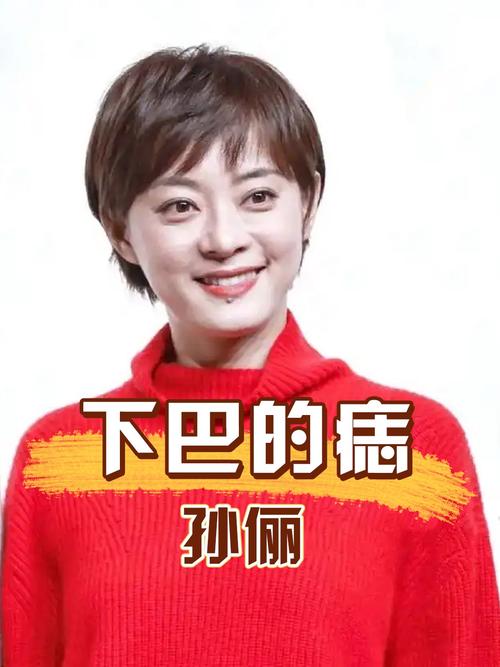2025新澳最新资料大全和孙俪唇下痣没了与孙俪嘴唇的痣