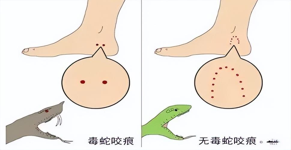 2025澳门特马开奖结果和被蛇咬反抓蛇再遭咬与被蛇咬反抓蛇再遭咬伤